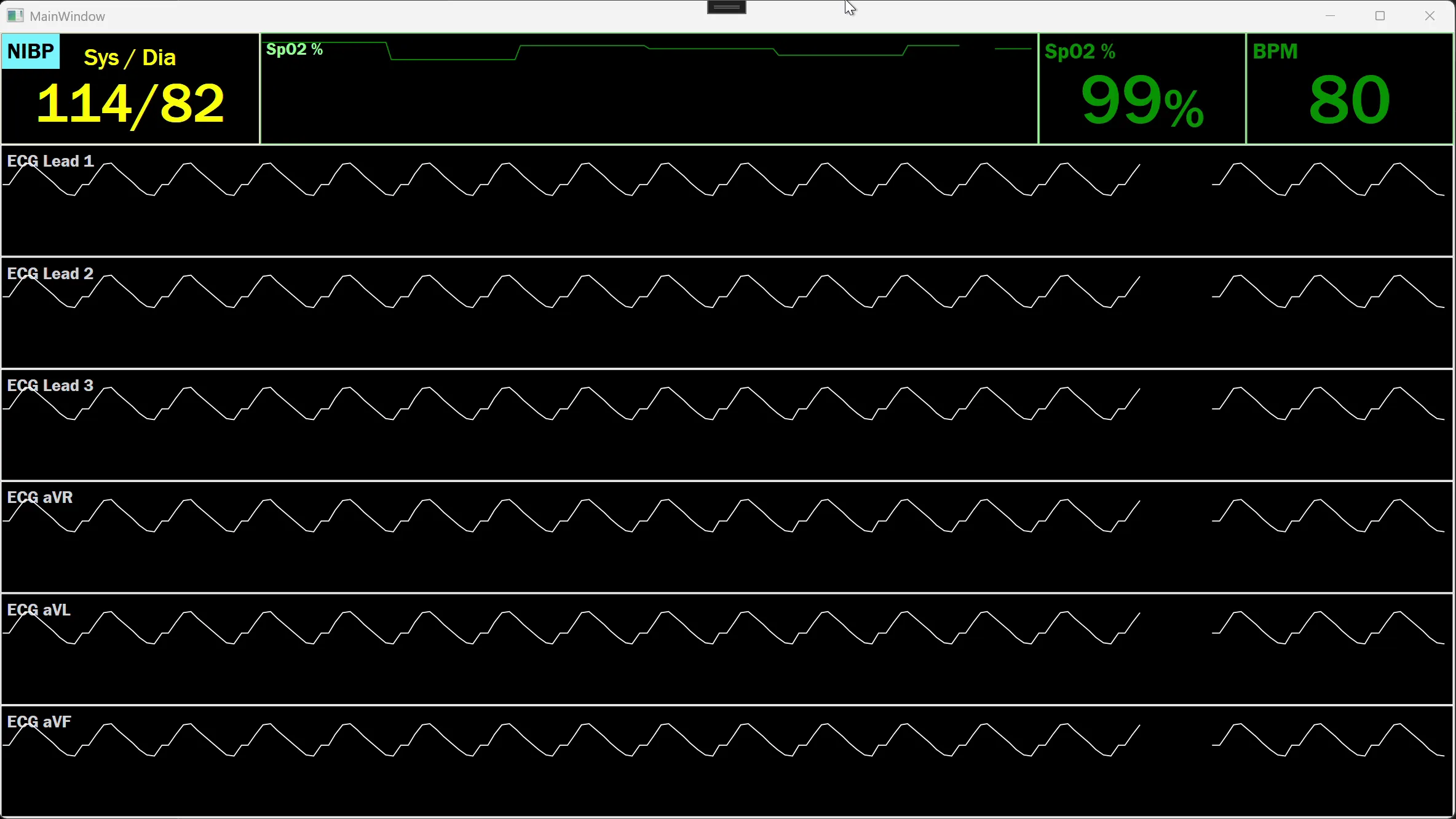 MedGraph — Vital Sign Visualization image